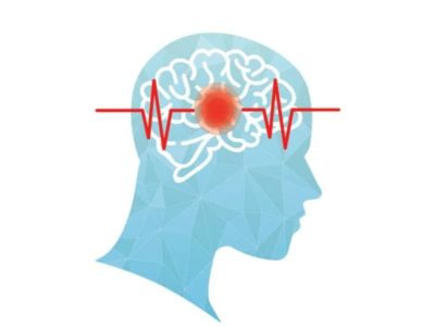 Бегом от инсульта