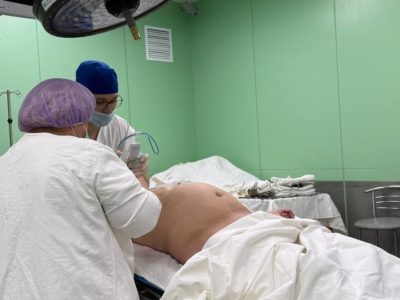 Врачи онкодиспансера удалили гигантское новообразование у калужанки