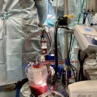 Врачи Калужской областной больницы провели уникальную операцию 