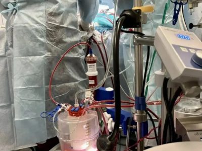 Врачи Калужской областной больницы провели уникальную операцию Врачи Калужской областной больницы провели уникальную операцию