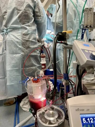 Врачи Калужской областной больницы провели уникальную операцию 