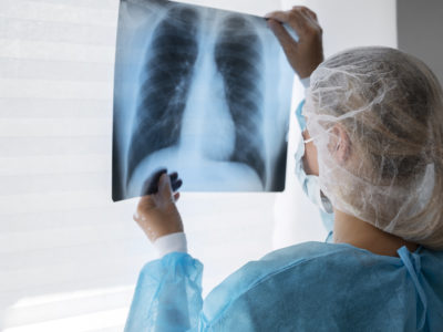 Коварная палочка Коха